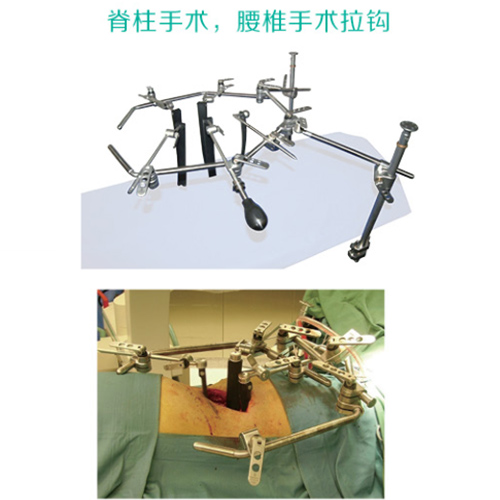 脊柱外科拉钩系统